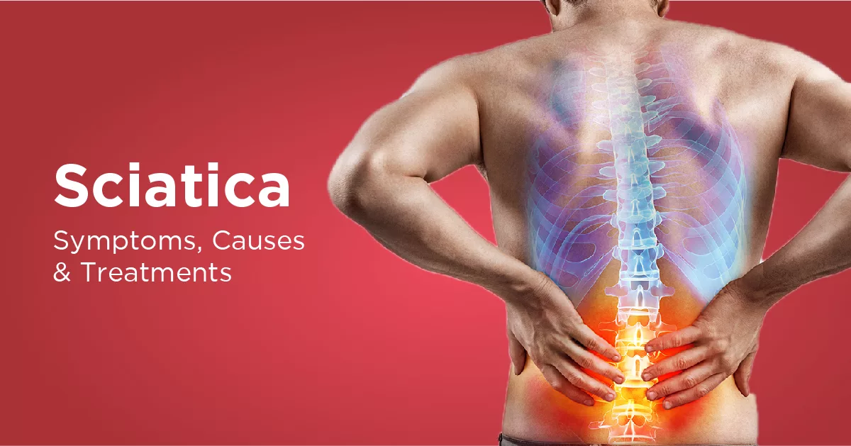 sciatica symptoms causes and treatment