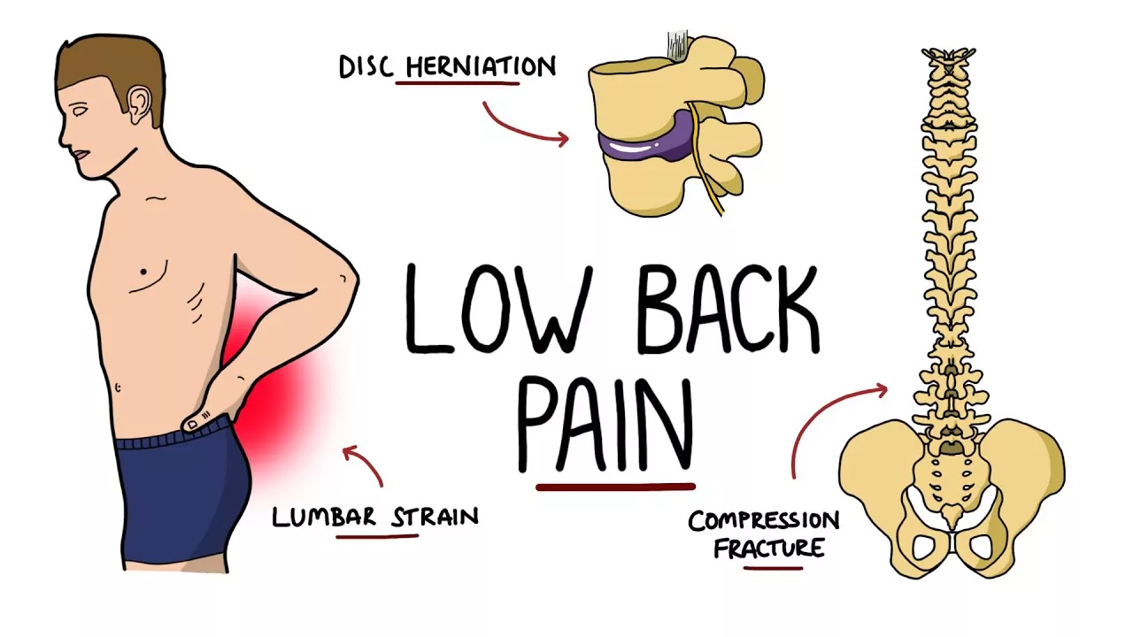Causes Of Low Back Pain