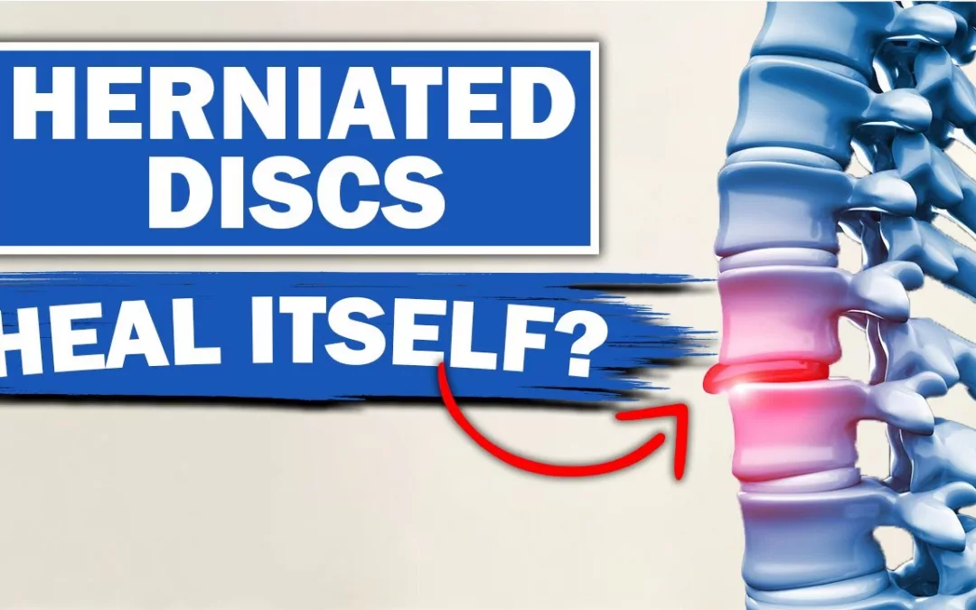 How Long Does a Herniated Disc Take to Heal?
