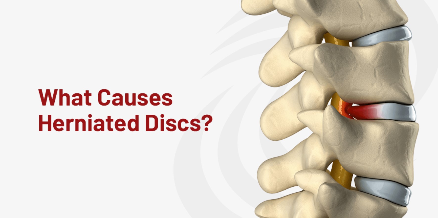 herniated disc symptoms herniated disc symptoms